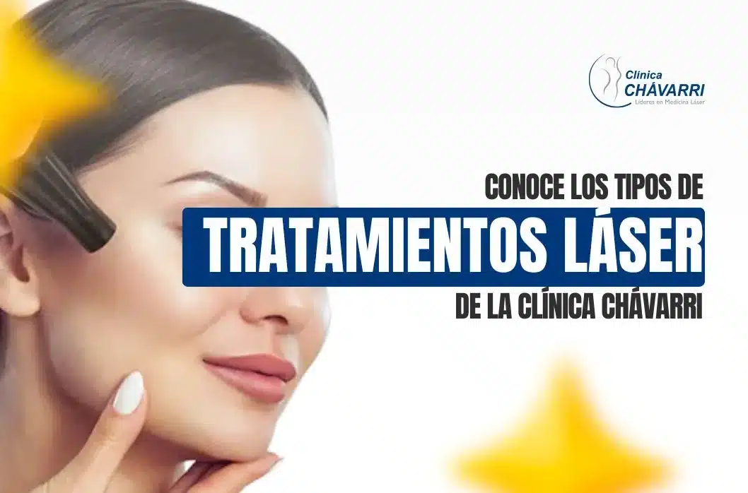 Conoce los tipos de tratamientos láser de la Clínica Chávarri