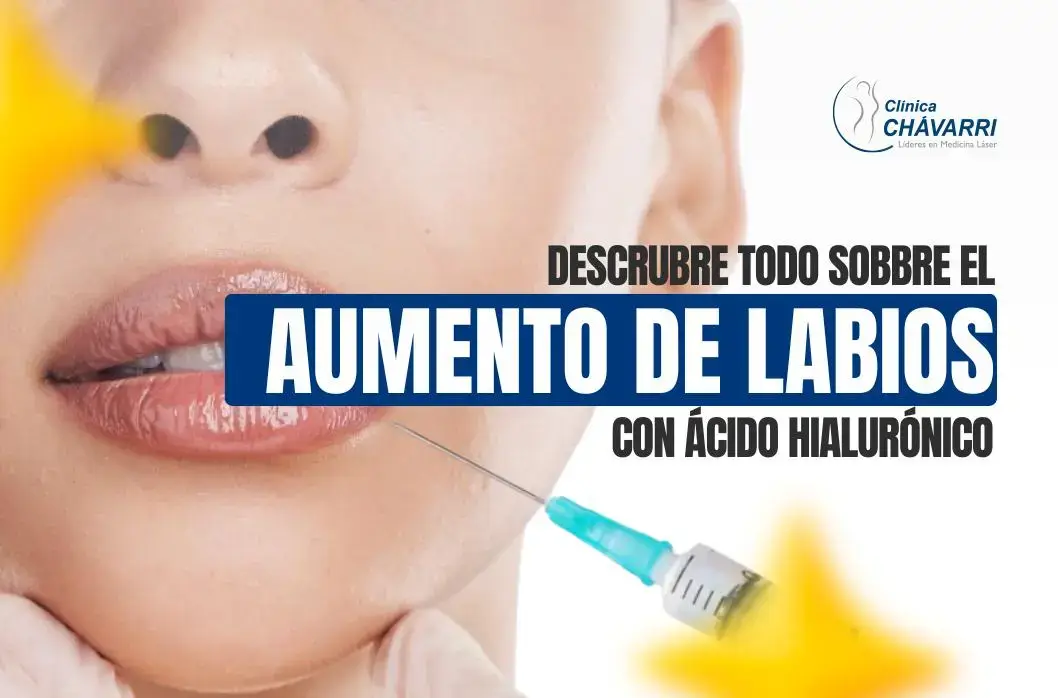 Descubre todo sobre el aumento de labios con ácido hialurónico