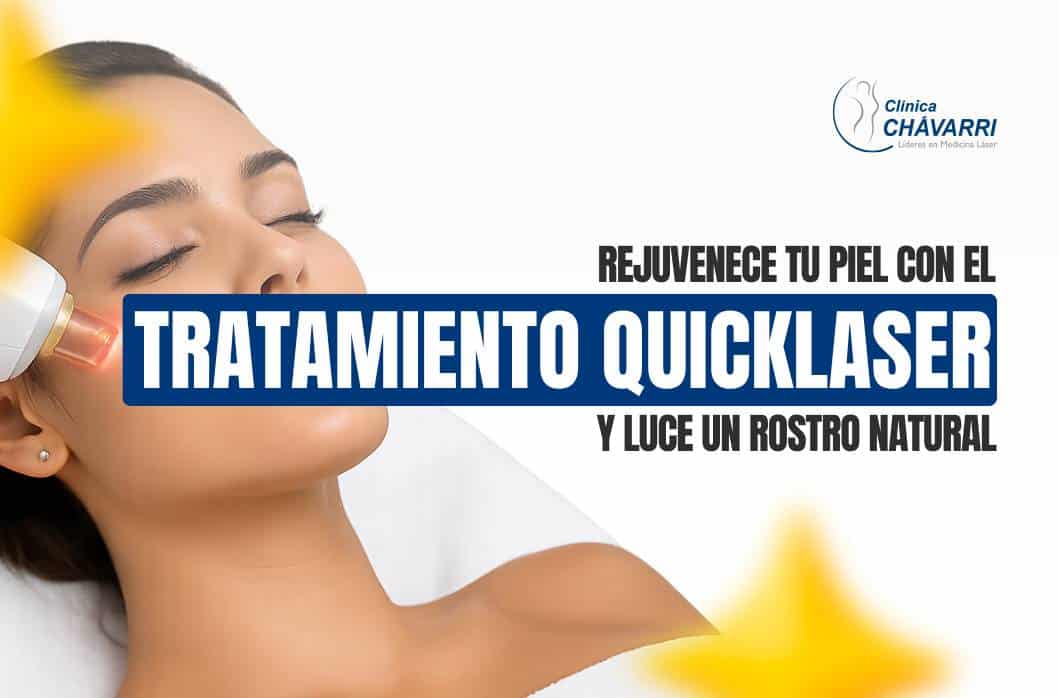 tratamiento-quicklaser-para-rejuvenecer-tu-piel