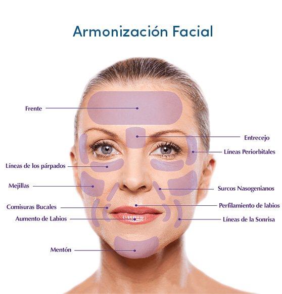 armonizacion-facial