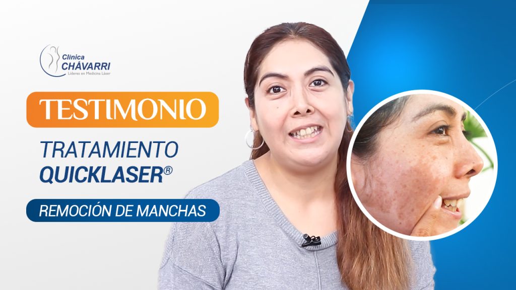 Atenuación de Manchas con Quicklaser