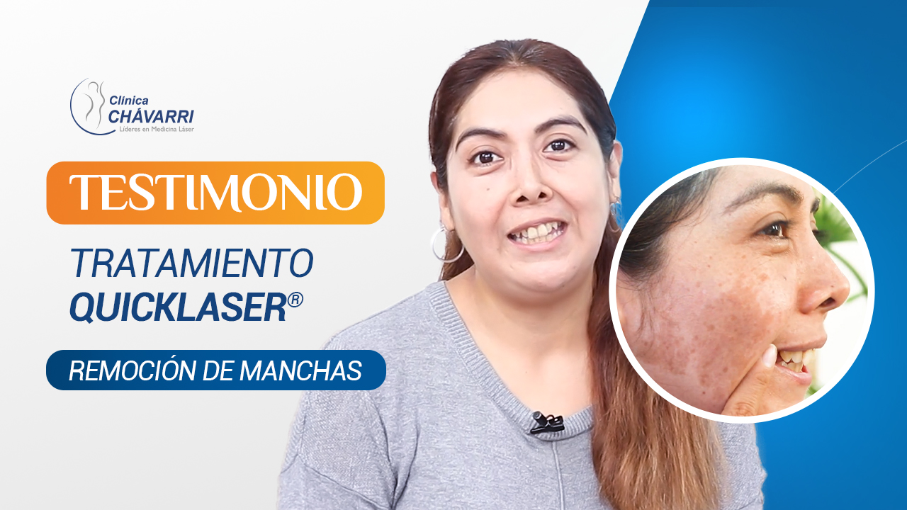 Atenuación de Manchas con Quicklaser