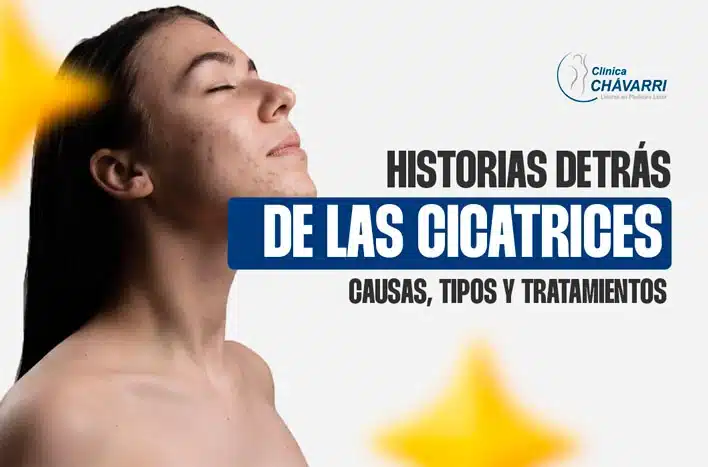 Cicatrices: Entendiendo y Tratando algunas Marcas de la Vida