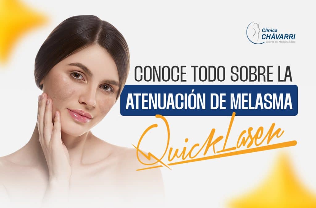 atenuacion de melasma_quicklaser
