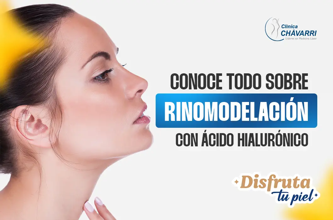 Rinomodelación con Ácido Hialurónico: La Alternativa No Quirúrgica para una Nariz Perfecta