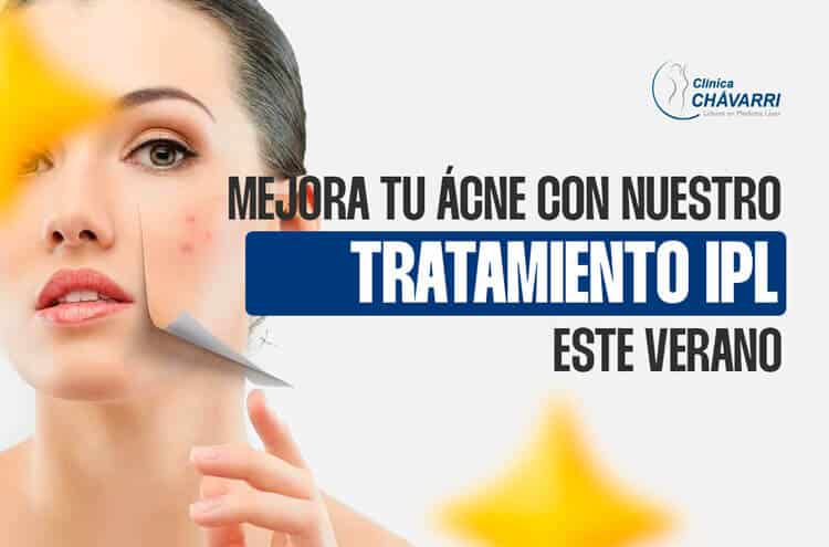 tratamiento-acne-laser-ipl-verano