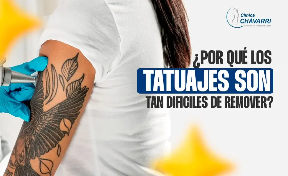 tatuajes-dificil-de-eliminar