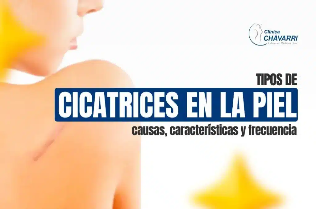 tipos-de-cicatrices-piel