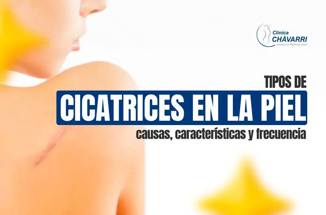 Tipos de cicatrices en la piel: causas, características y frecuencia