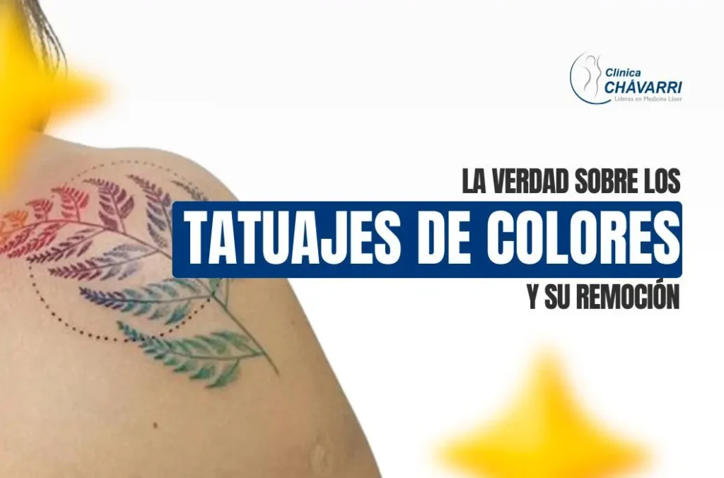 eliminar-tatuajes-de-colores