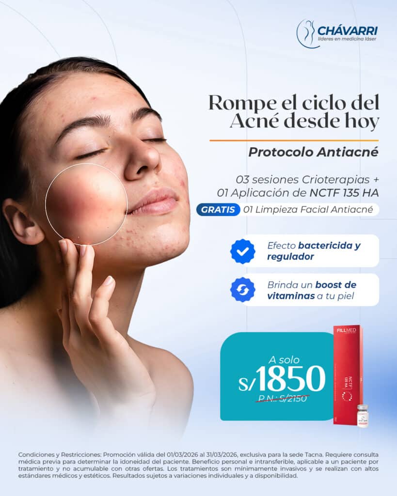 promos-tacna