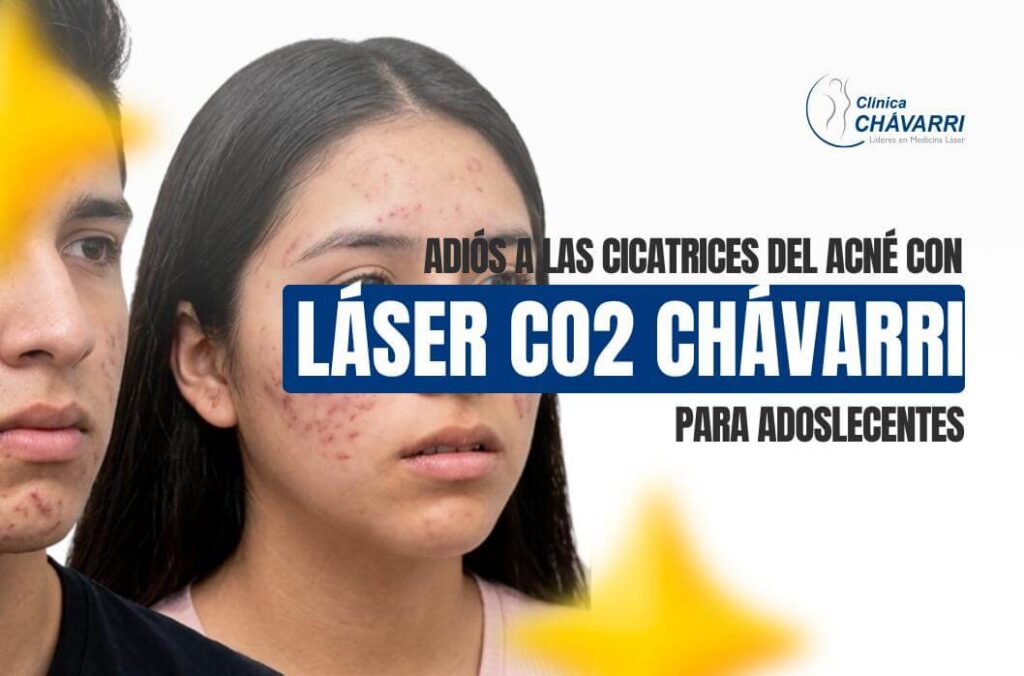 acne-adolescentes-tratamiento-secuelas-manchas