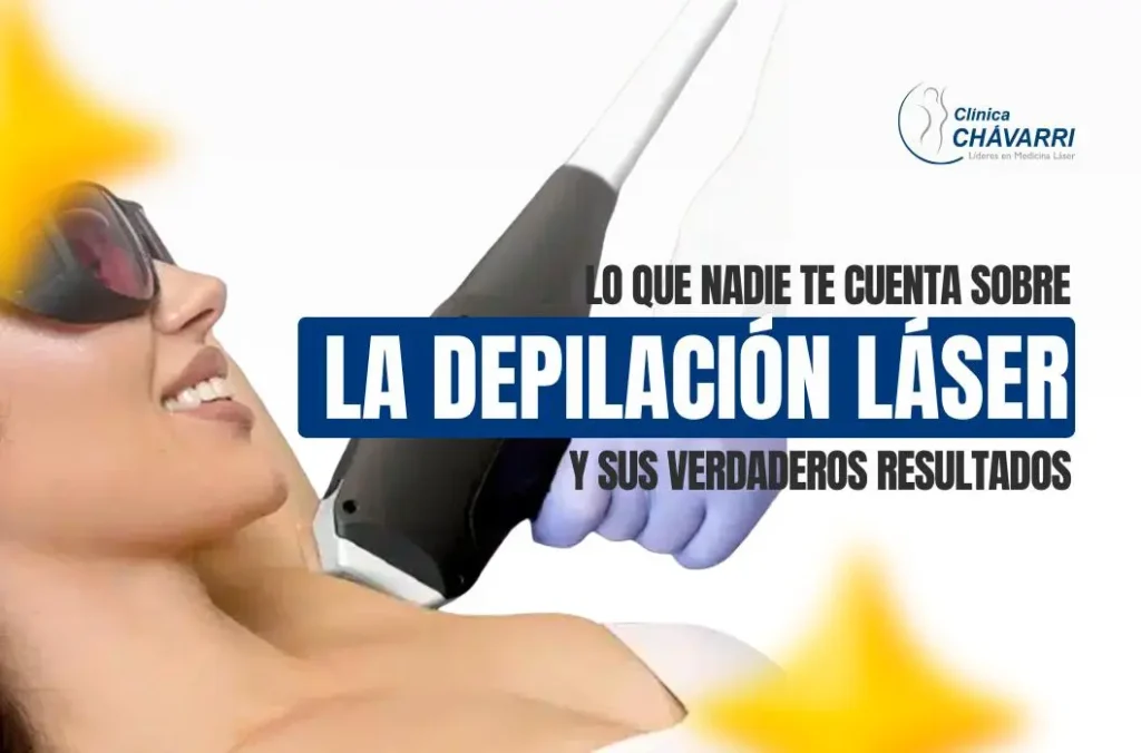 todo-sobre-depilacion-laser-resultados