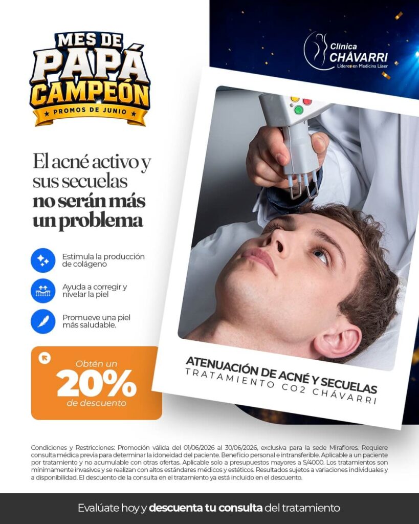 tratamiento-acne-activo-dia-del-padre