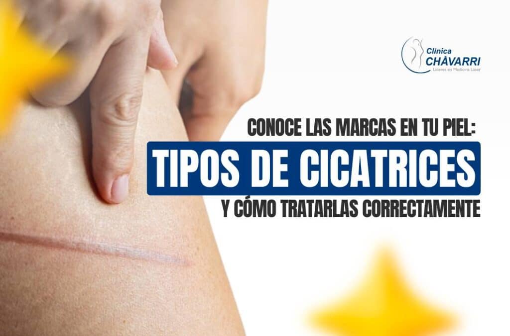 tipos-de-cicatrices-tratamientos