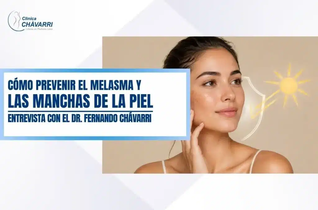 como-prevenir-melasma-manchas-en-la-piel
