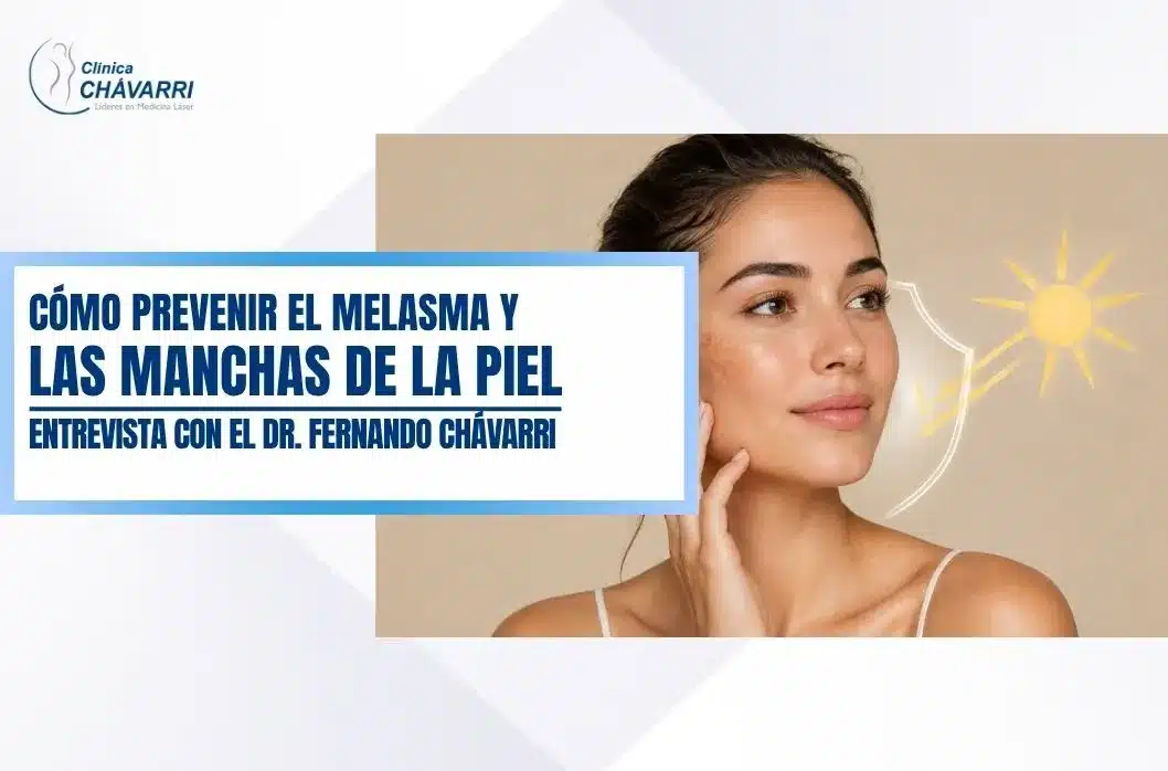 como-prevenir-melasma-manchas-en-la-piel