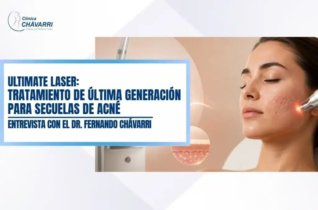 ultimate-laser-tratamiento-secuelas-acne