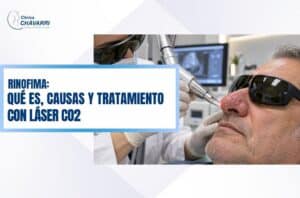 rinofima-que-es-causas-tratamiento